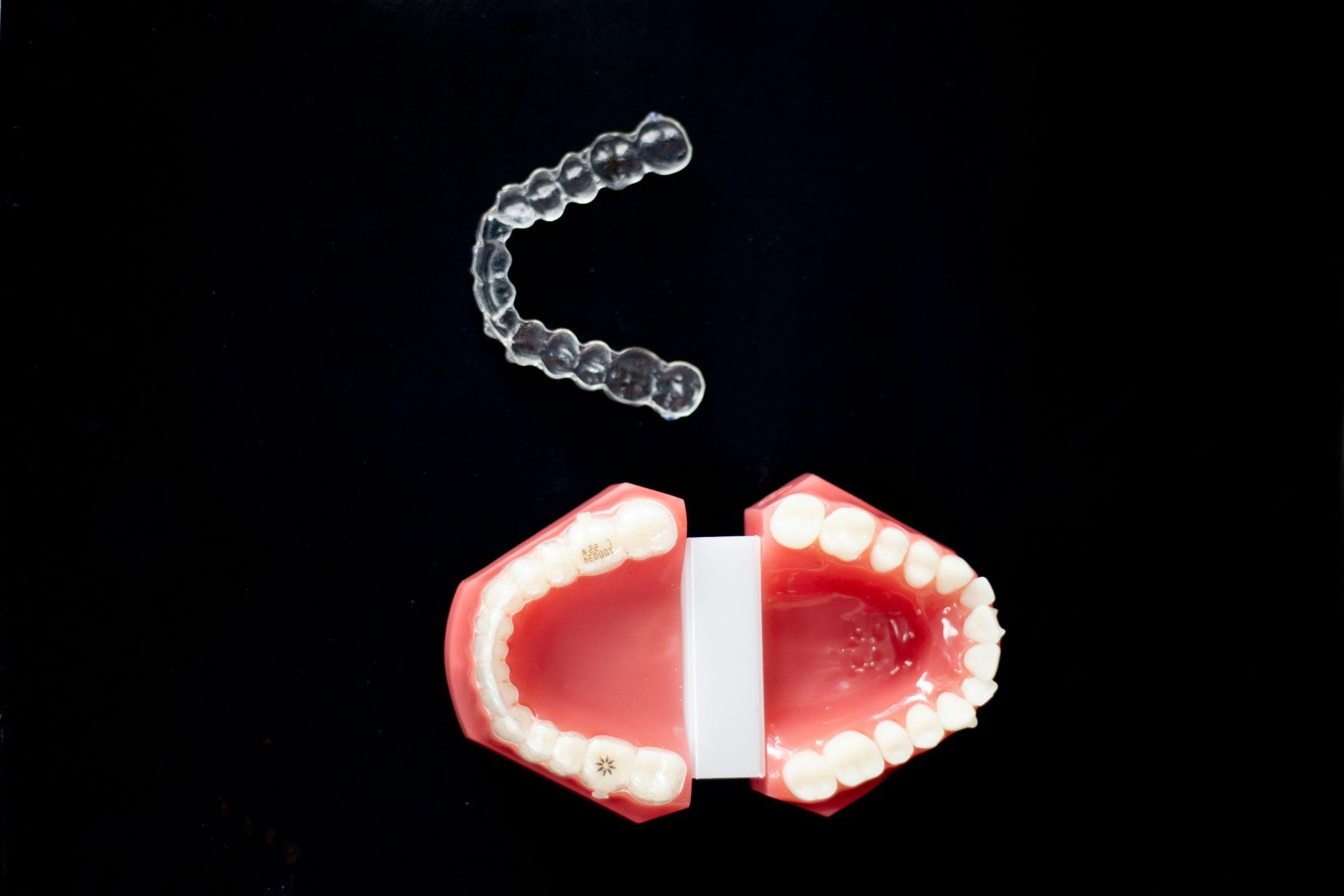 A transparent dental aligner is displayed above a dental model to illustrate personalized custom mouthguards in Fresno.