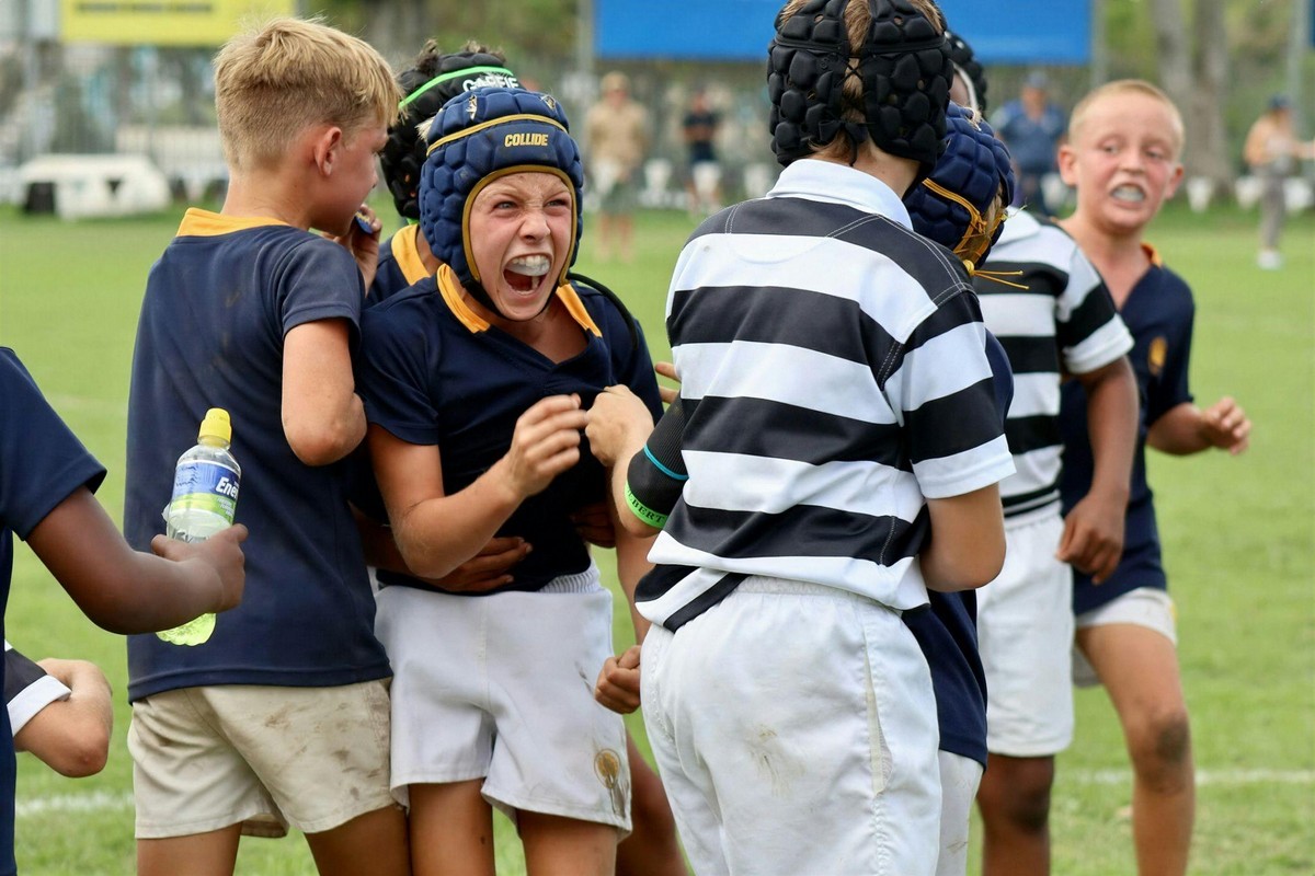 Young rugby players wearing custom mouthguards in Tulare for protection during a contact sport.