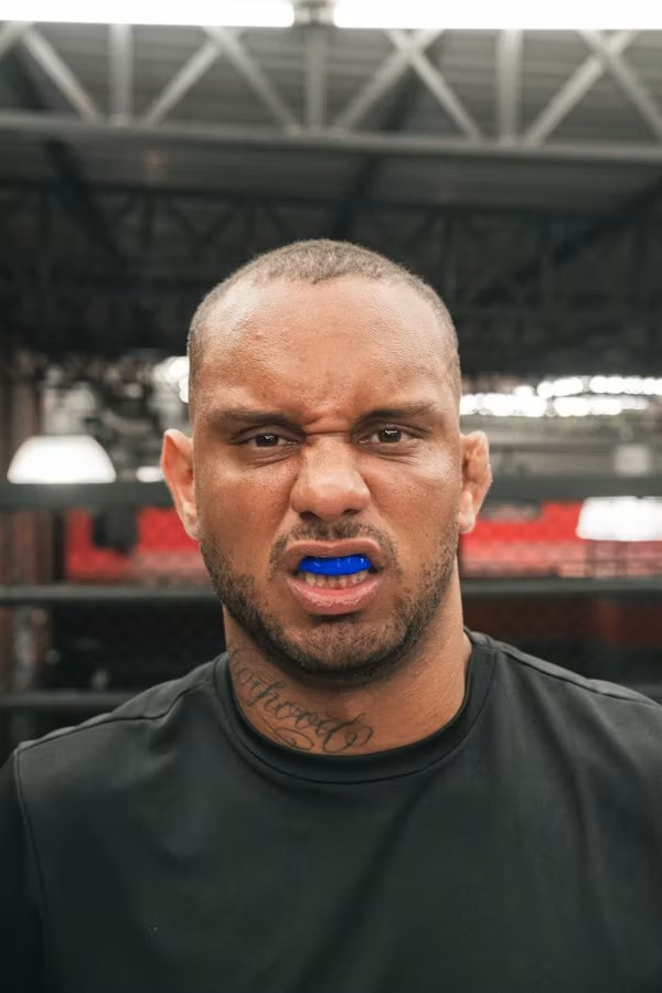 Custom mouthguards in Kingsburg for comfortable sports protection